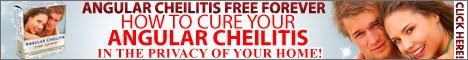 Angular Cheilitis Free Forever