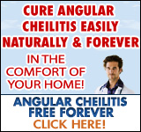 Angular Cheilitis Free Forever