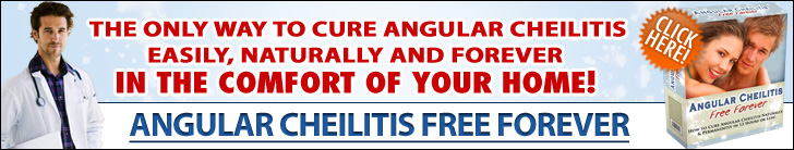 Angular Cheilitis Free Forever